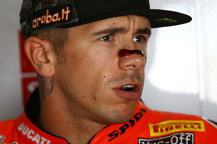 Scott Redding redet nie drumherum