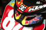 Muss Jeffrey Herlings den Rest der Saison pausieren?