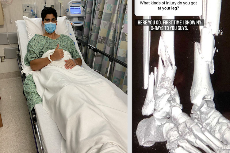 Juan Manuel Corra: Mehr als 20 Operationen nach schlimmen Beinverletzungen