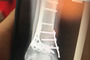 Cal Crutchlow: So sieht der 3D CRT-Scan aus
