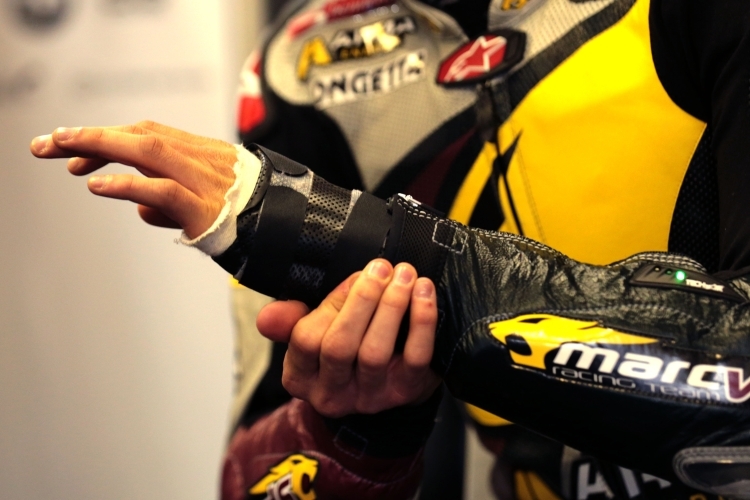Scott Redding's verletzte Hand