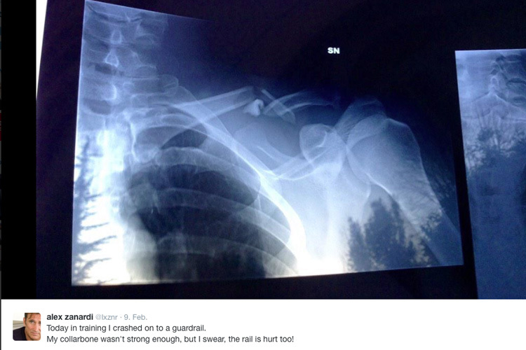 Alex Zanardi postete gleich selber ein Röntgenbild des gebrochenen Schlüsselbeins