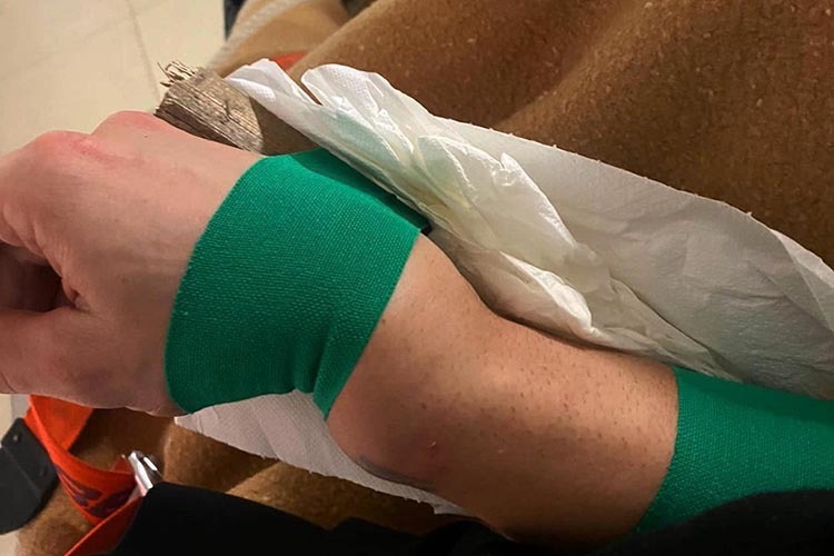 Dovi kam mit einem stark geschwollenen rechten Handgelenk ins Spital