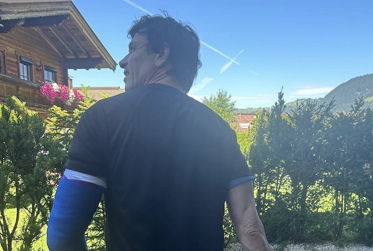 Toto Wolff: Der linke Arm ist nach dem Unfall eingegipst