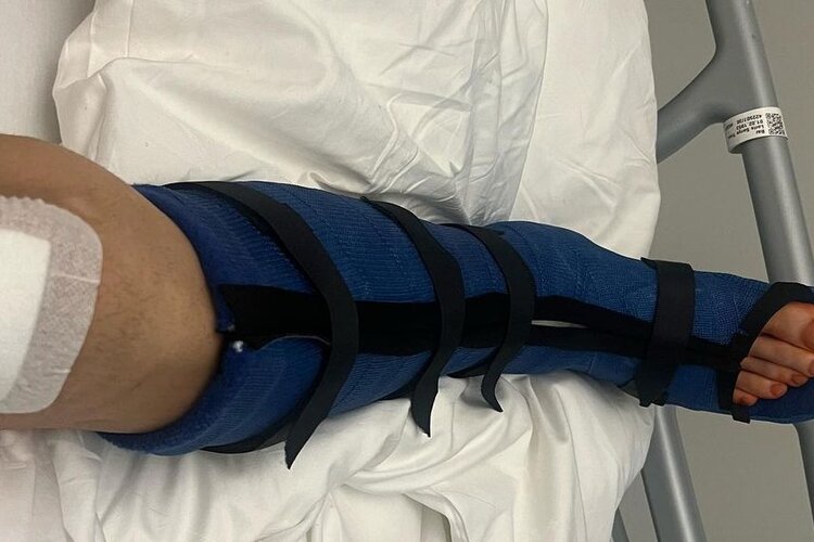 Das rechte Bein wurde in der Schweiz operiert